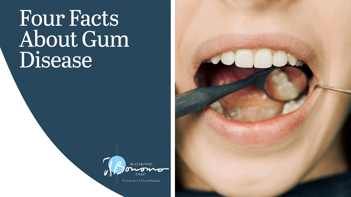 Four Facts About Gum Disease 